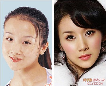 娱乐圈女明星大饼脸惊变锥子